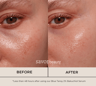 before and after results of 48 hours use of blue tansy serum 
